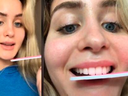 Una mujer se lima los dientes como parte de un reto viral que supuestamente persigue conseguir una dentadura perfecta.
