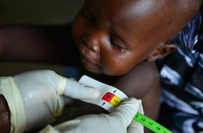 Un sanitario monitoriza el estado de nutrición de un niño en Sudán del Sur.