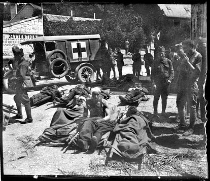 Julio de 1918. Heridos americanos en Pierrefont, Francia (nota manuscrita del autor sobre el negativo de vidrio).