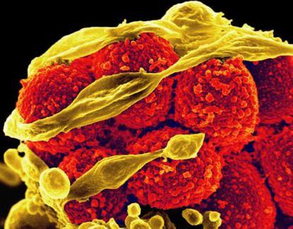 En amarillo, la bacteria 'Staphylococcus aureus' escapa de un glóbulo blanco