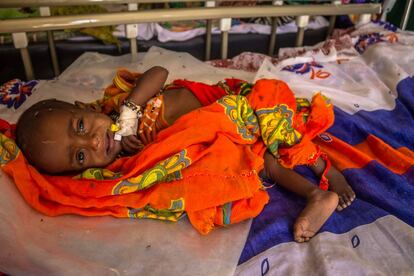 Un niño ingresado en la unidad de desnutrición de Liwa, en la región del Lago Chad (Chad).