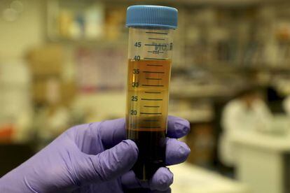 Un investigador sostiene una muestra de sangre en el laboratorio del biobanco del Gregorio Marañón.