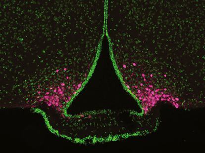 Imagen microscópica de parte del cerebro de roedor que muestra un grupo de células conocidas como neuronas AgRP (teñidas de magenta) ubicadas en la base del hipotálamo.