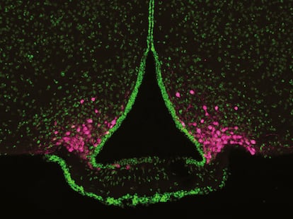 Microscopic image of a portion of the rodent brain shows a collection of cells known as AgRP neurons (stained magenta), which are located at the base of the hypothalamus.