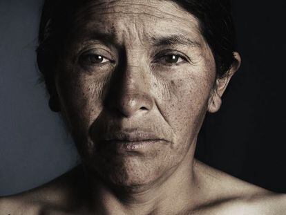 Imagen perteneciente a la serie sobre mujeres bolivianas maltratadas.
