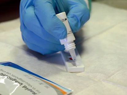 Test rápido serológico para detectar anticuerpos del coronavirus.