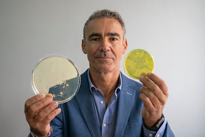 El microbiólogo Bruno González Zorn muestra dos cultivos bacterianos en su despacho de la Universidad Complutense de Madrid.