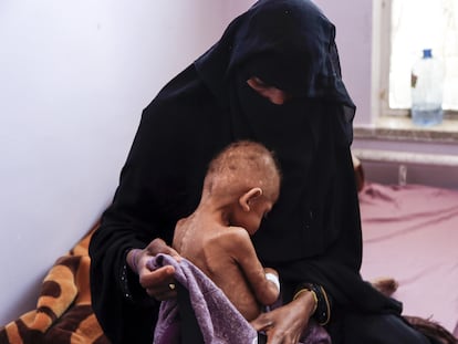 Una mujer abraza a su hijo desnutrido en el Hospital Materno Al Sabeen, en Sanaa (Yemen) el 13 de febrero.