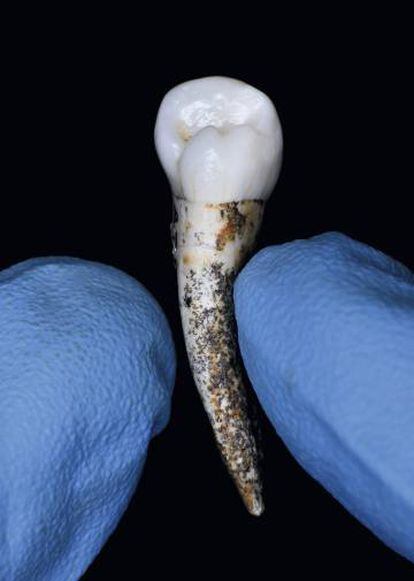 Un diente conservado en el CENIEH.