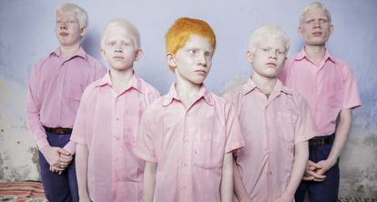 Niños albinos ciegos en India, retratados en septiembre de 2013 para Getty Images.