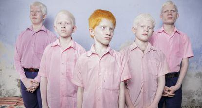 Ni&ntilde;os albinos ciegos en India, retratados en septiembre de 2013 para Getty Images.