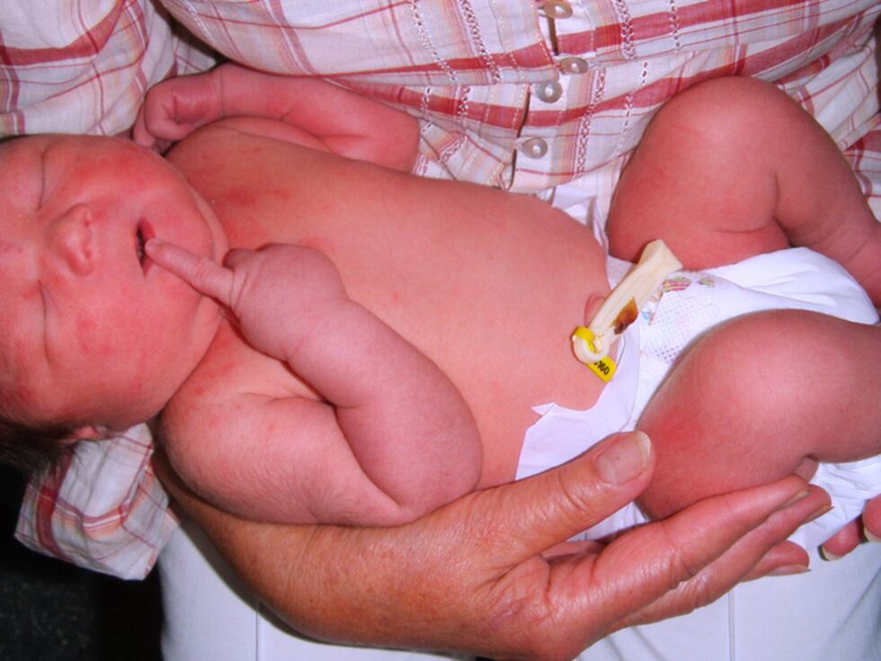 Un Parto Y Un Posparto Diferentes Actualidad Noticias De Hoy El Pais