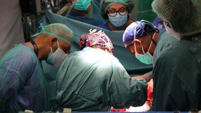 Imagen de la intervención en un quirófano del Hospital Vall d'Hebron.