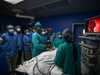 Una cirugía para extirpar la mucormicosis de un paciente de covid en la India.