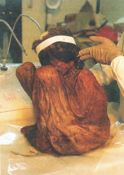 La momia del Aconcagua.