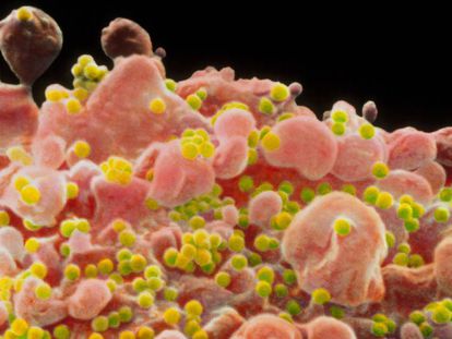 Imagen microscópica del del virus del VIH.