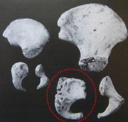 Imagen de los huesos del informe elaborado por el forense Francisco Etxeberria..