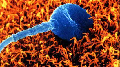 Un espermatozoide humano intenta fecundar un óvulo. Imagen de microfotografía electrónica.