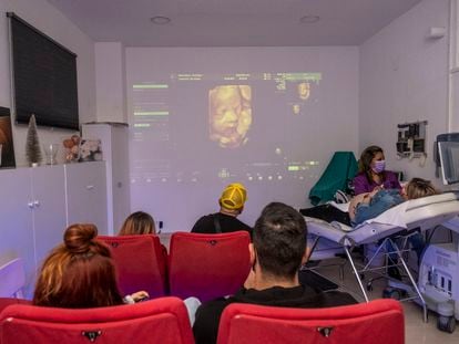 Cayetana Pingarrón se realiza una ecografía en 5D mientras su marido Mario Coloma y varios asistentes observan la proyección de la imagen en la pantalla del centro BabyCine.