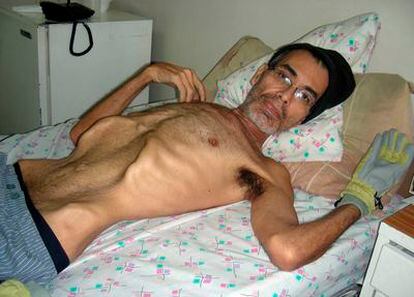 El agricultor venezolano Franklin Brito en la cama del Hospital Militar en el que ha muerto después de varios meses en huelga de hambre.