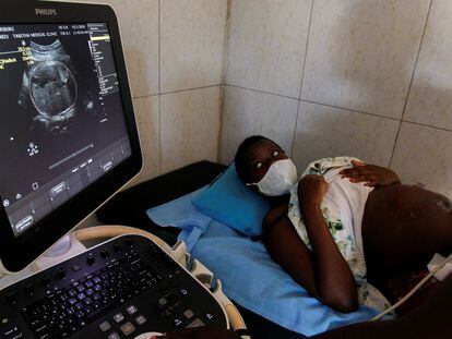 La estudiante de secundaria Jackline Bosibori, de 17 años, durante una ecografía en el Hospital Clínico de Tabitha de Kibera, en Kenia, el 2 de octubre de 2020.