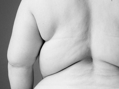 Un 16% de los adultos en el mundo sufre obesidad, según la OMS.