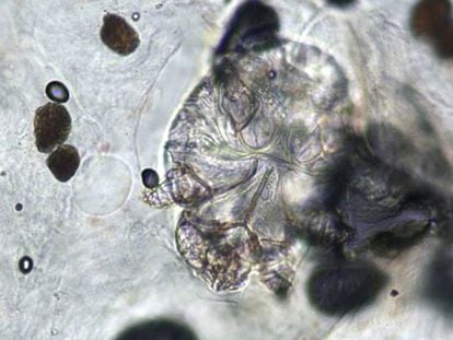 Imatge microscòpica de l'àcar que provoca la sarna.