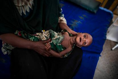 Una madre sujeta a su hijo, con síntomas de desnutrición, en el hospital de Trocaire, en Dolow.