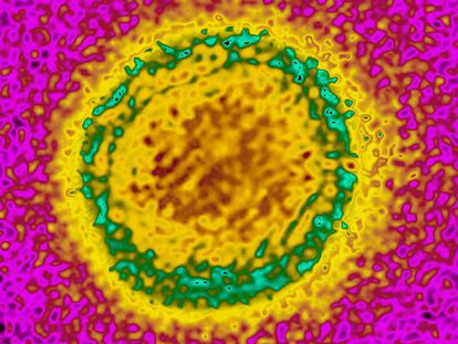 Un virus del dengue, visto con un microscopio electrónico.