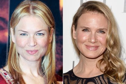 Renée Zellweger.