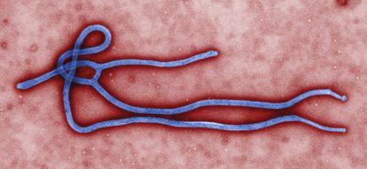 Imagen sin fechar facilitada por el centro de prevención y control de enfermedades que muestra el virus del Ébola creado por el centro de microbiología de Cynthia Goldsmith.