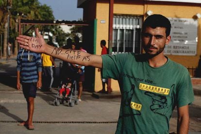 Un ciudadano sririo residente en el CETI de Melilla escribe en su brazo pidiendo ayuda.