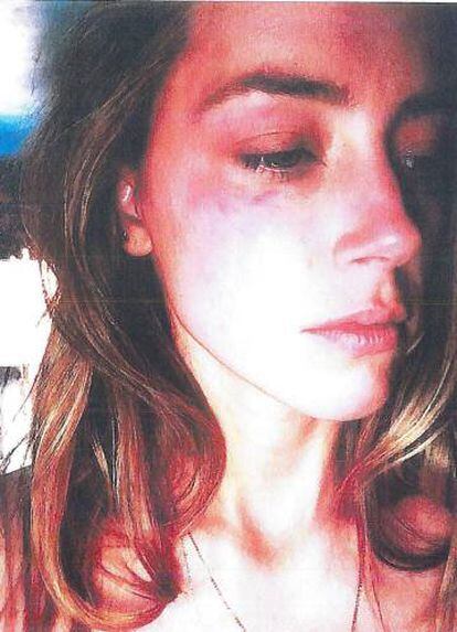 Imagen que presentó Amber Heard como prueba de que Depp la había golpeado.