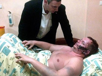 El líder de la oposición ucrania, Vitali Klitschko, habla con uno de sus compañeros, Bulátov, en el hospital. / Reuters-LIVE! / Reuters