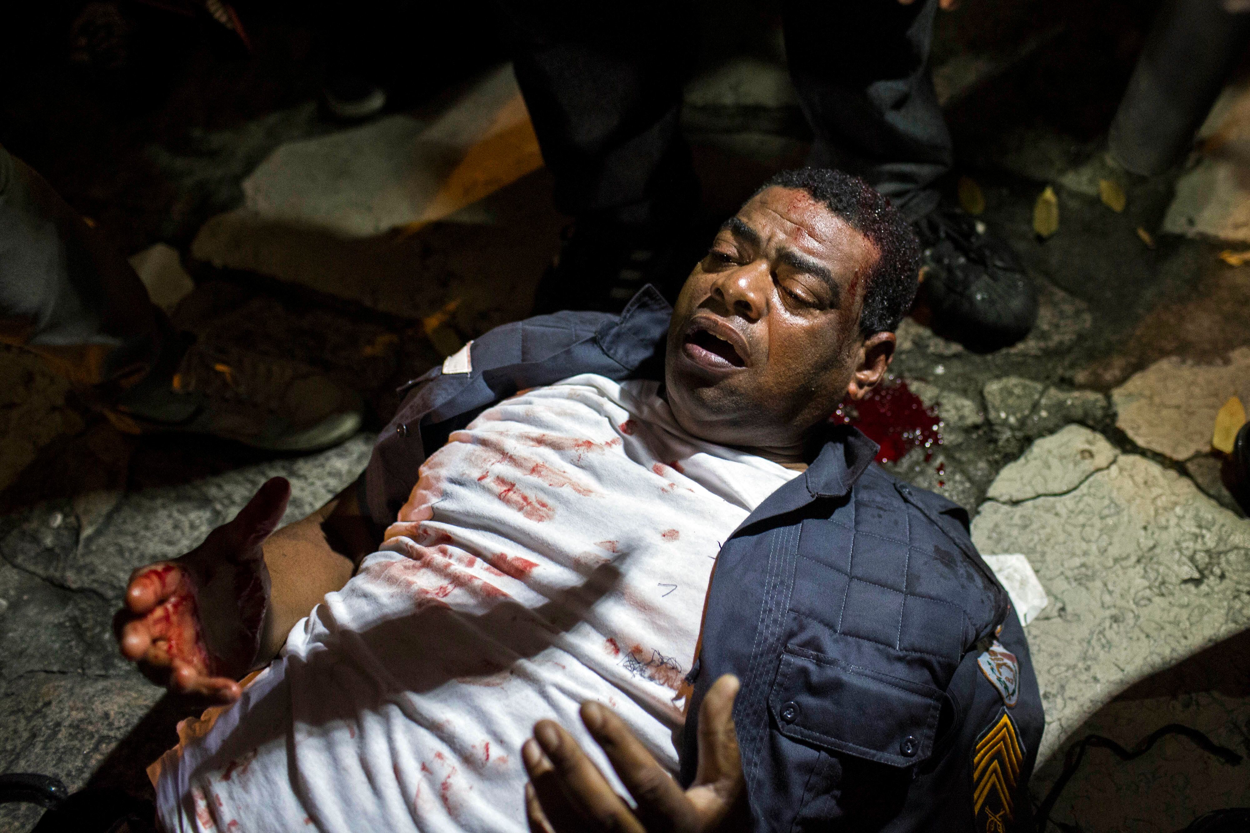 Un policía herido durante enfrentamientos con manifestantes, el 17 de junio de 2013 en Río de Janeiro.