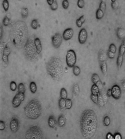 Células infectadas por el tripanosoma que causa la enfermedad de Chagas.