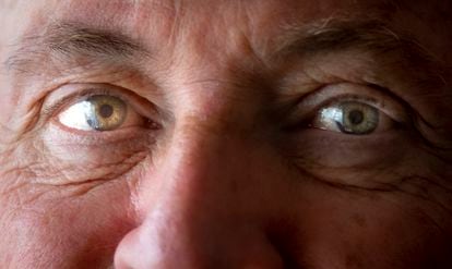 Los ojos del cirujano Antonio de Lacy, tan importantes como las manos en el quirófano.