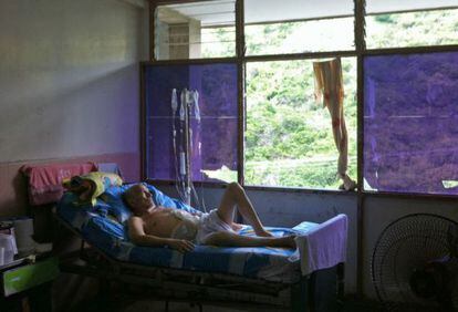 Un paciente en el hospital Central de Maracay, Venezuela.
