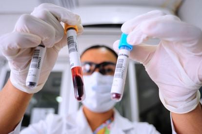 Una bióloga revisa dos muestras de sangre antes de analizarlas en Atlacomulco, México.