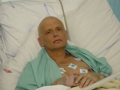 El agente Alexander Litvinenko tras ser intoxicado con polonio 2010. 