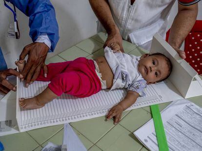 Uno de los niños atendidos en el centro médico que utiliza Médicos Sin Fronteras en el pueblo colombiano de La Gabarra, Norte de Santander, de lunes a viernes, desde 2018.
