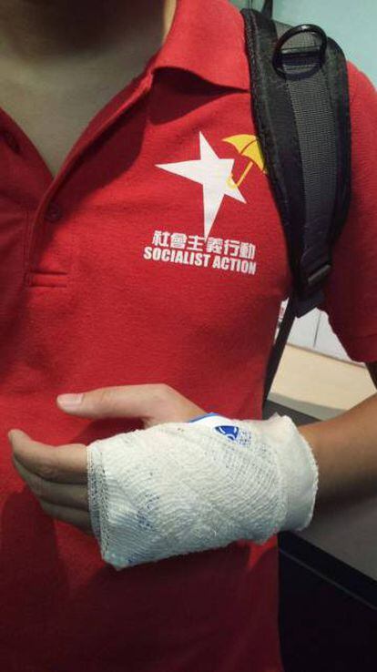 Uno de los manifestantes chinos, que afirma haber recibido atenci&oacute;n hospitalaria tras el altercado.