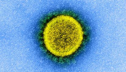 Otra imagen del coronavirus SARS-CoV-2