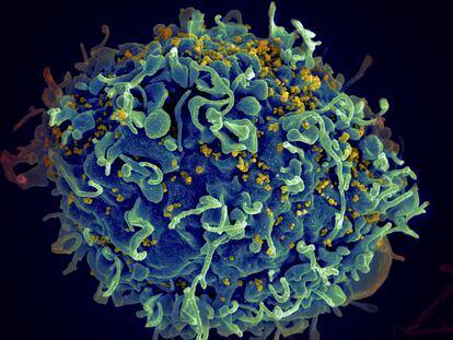 Imagen de microscopio electrónico facilitada por los Institutos Nacionales de Salud de EE. UU. Muestra una célula T humana, en azul, atacada por el VIH, el virus que causa el sida, en amarillo.