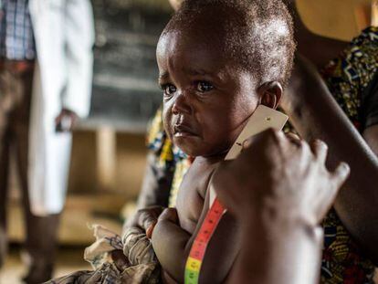 Un enfemero mide el per&iacute;metro braquial de un ni&ntilde;o para saber si padece desnutrici&oacute;n en Mbau, RDC. 