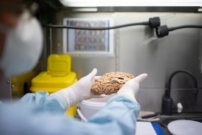 El patólogo Alberto Rábano muestra un cerebro humano del Banco de Tejidos de la Fundación CIEN.